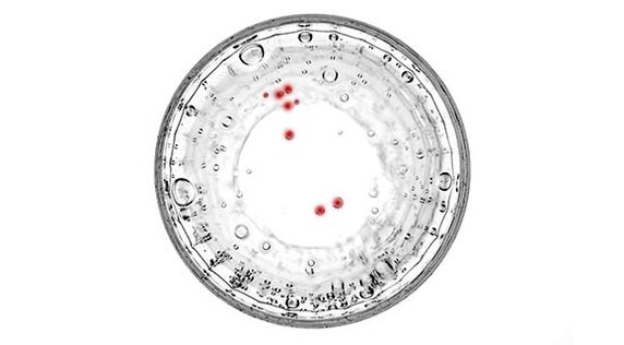 Se tes síntomas de prostatite, debes facerte unha proba para detectar infeccións ocultas.